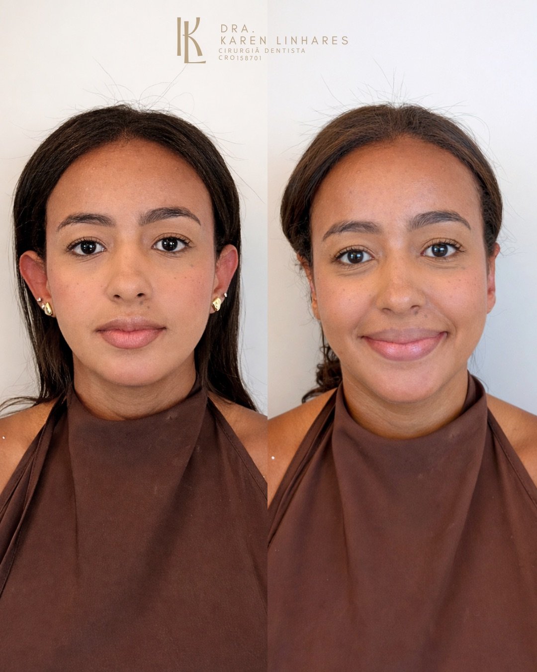 Caso clínico facial
